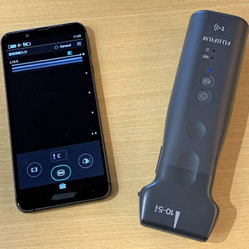 携帯型超音波診断装置 iViz air